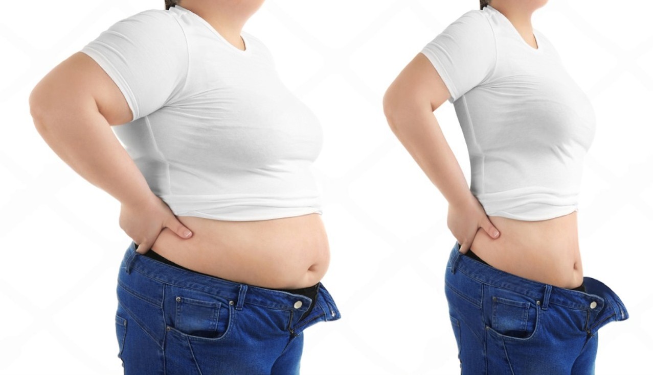 stock photo young woman before and after liposuction operation on white background side view cosmetic surgery 1172579071